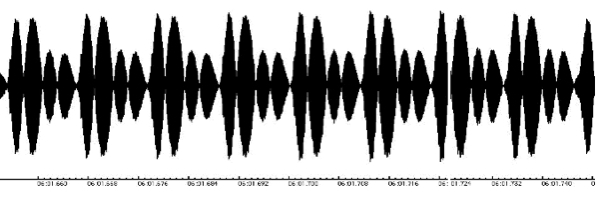 Audio Waveform 3