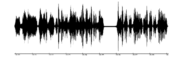 Audio Waveform 1